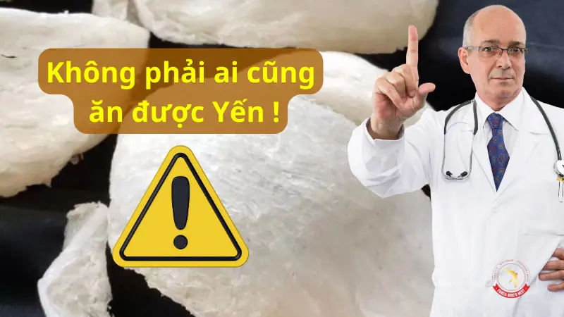 nhung-luu-y-khi-an-yen